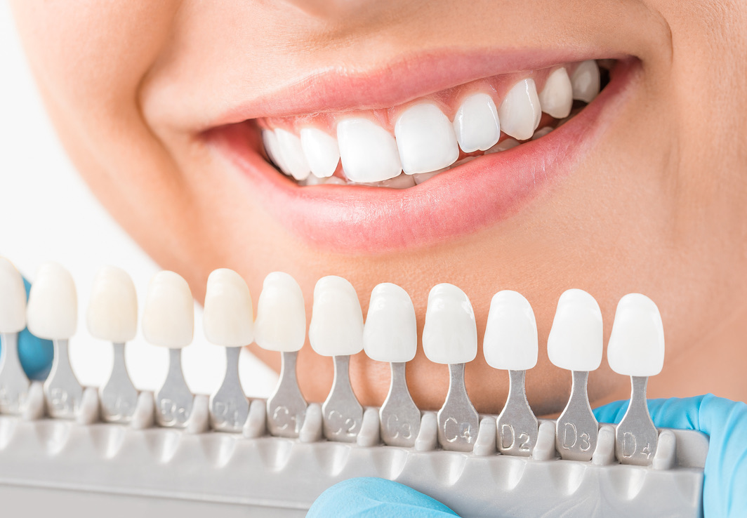 Beautiful smile and white teeth of a young woman.